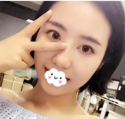 时间不等人,去眼袋要趁早! 时间不等人,去眼袋要趁早!