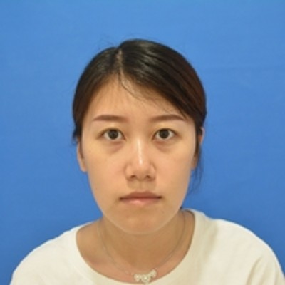 去眼袋效果经得起考验——超声波去眼袋!790 去眼袋效果经得起考验——超声波去眼袋!790