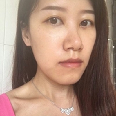 去眼袋效果经得起考验——超声波去眼袋!790 去眼袋效果经得起考验——超声波去眼袋!790