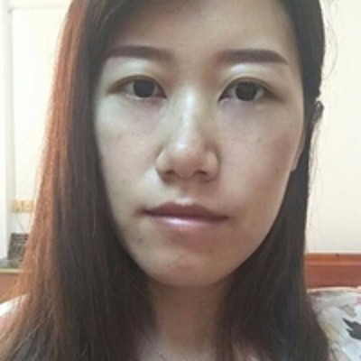 去眼袋效果经得起考验——超声波去眼袋!790 去眼袋效果经得起考验——超声波去眼袋!790