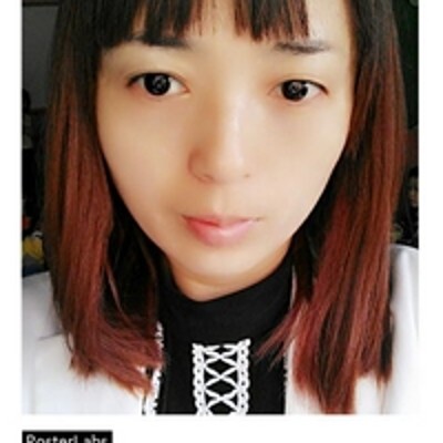 超声波去眼袋,没有眼袋烦恼683 超声波去眼袋,没有眼袋烦恼683