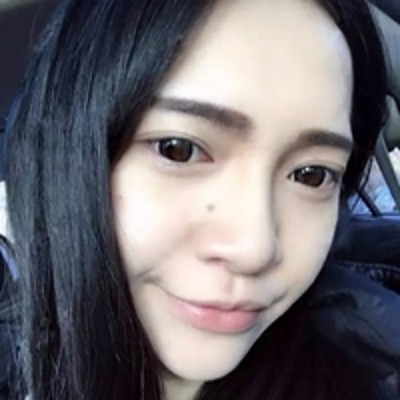 超声波去眼袋自然到眼袋从未来过一样!377 超声波去眼袋自然到眼袋从未来过一样!377