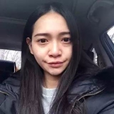 超声波去眼袋自然到眼袋从未来过一样!377 超声波去眼袋自然到眼袋从未来过一样!377