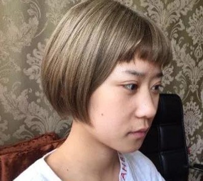 超声波去眼袋,根除眼袋353 超声波去眼袋,根除眼袋353