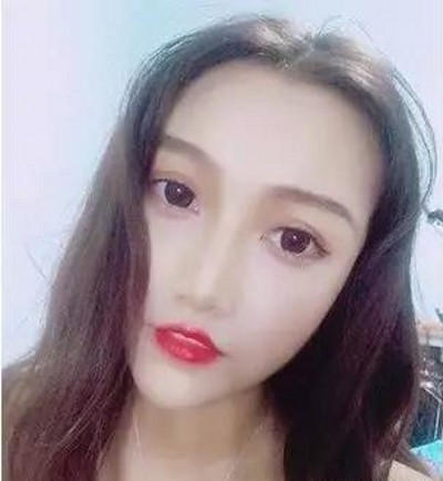 超 声 波去眼袋,让wǒ看起来朝气蓬勃 超 声 波去眼袋,让wǒ看起来朝气蓬勃
