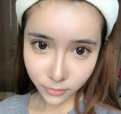 重庆超雅超声波去眼袋,让我没有再长过眼袋了443 重庆超雅超声波去眼袋,让我没有再长过眼袋了443