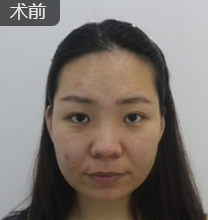 重庆超雅超声波瘦脸,轻松搞定脸大问题143 重庆超雅超声波瘦脸,轻松搞定脸大问题143