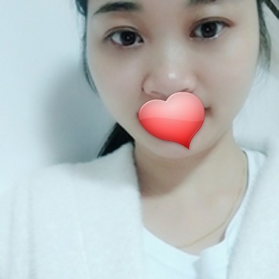 超声波去眼袋让我在演员这条路上走的顺风顺水！458