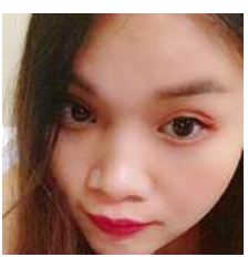 去眼袋日记——我与超雅的结缘来自超声波去眼袋608