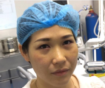 重庆超雅超声波去眼袋让你青春定格383 重庆超雅超声波去眼袋让你青春定格383