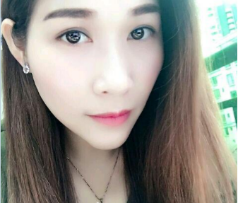 重庆超雅超声波去眼袋让你青春定格383 重庆超雅超声波去眼袋让你青春定格383