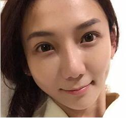 严重的眼袋,超声波去眼袋分分钟去掉404 严重的眼袋,超声波去眼袋分分钟去掉404