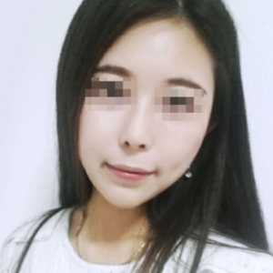 在重庆超雅做超级微拉美手术得超真实体验 在重庆超雅做超级微拉美手术得超真实体验