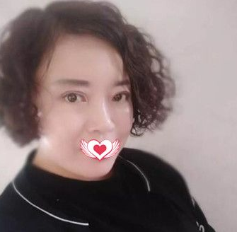 面部提升术