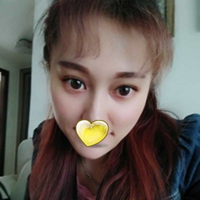 我和超声波去眼袋的缘分898 我和超声波去眼袋的缘分898