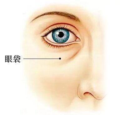 我来告诉大家怎么快速去眼袋902 我来告诉大家怎么快速去眼袋902