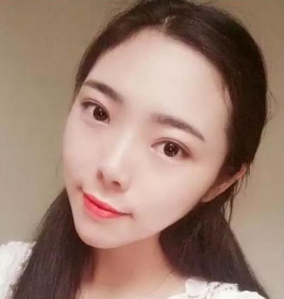 重庆超雅超声波去眼袋,美女的特质尽显266 重庆超雅超声波去眼袋,美女的特质尽显266