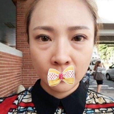 爱妈妈就让她去做超声波去眼袋吧!318 爱妈妈就让她去做超声波去眼袋吧!318