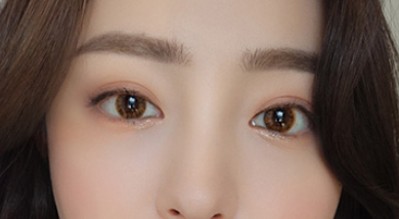 萌萌得大眼睛wǒ也可以有！谢谢重庆超雅梁医生！