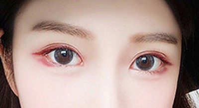 萌萌得大眼睛wǒ也可以有！谢谢重庆超雅梁医生！
