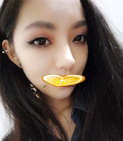 超声波双眼皮你怎么可以让我这么美?171 超声波双眼皮你怎么可以让我这么美?171
