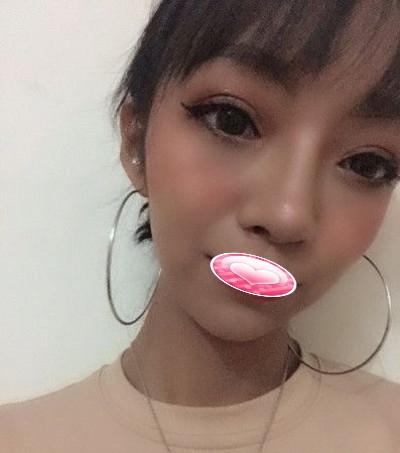 超声波双眼皮你怎么可以让我这么美?171 超声波双眼皮你怎么可以让我这么美?171