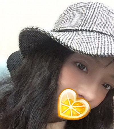 超声波双眼皮你怎么可以让我这么美?171 超声波双眼皮你怎么可以让我这么美?171
