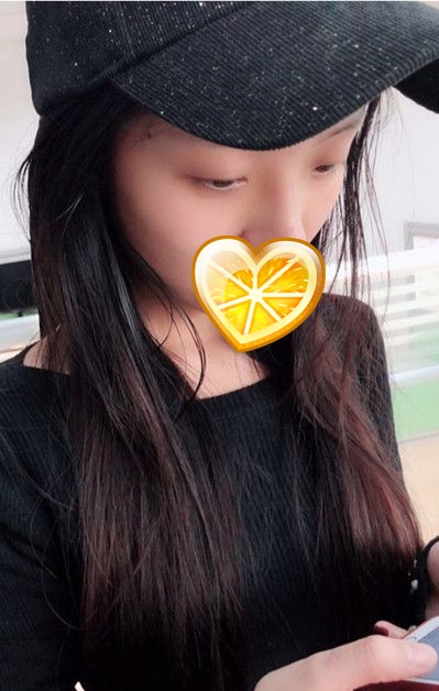超声波双眼皮你怎么可以让我这么美?171 超声波双眼皮你怎么可以让我这么美?171