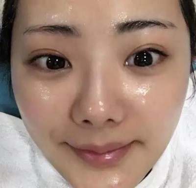重庆超雅超声波双眼皮,让眼睛更加魅力943 重庆超雅超声波双眼皮,让眼睛更加魅力943