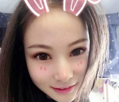重庆超雅超声波双眼皮，朋友们都说我变漂亮了很多呢287
