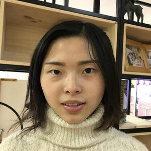 跟二十多年肿泡眼说再见，重庆超雅超声波双眼皮551