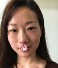 重庆超雅自体脂肪填充术是值得选择的!147 重庆超雅自体脂肪填充术是值得选择的!147