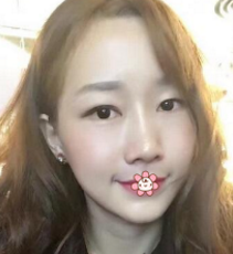 重庆超雅自体脂肪填充术是值得选择的!147 重庆超雅自体脂肪填充术是值得选择的!147