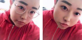 总觉得做去眼袋手术就得去重庆超雅976 总觉得做去眼袋手术就得去重庆超雅976