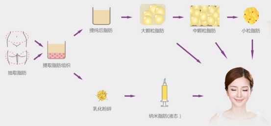 重庆超雅自体脂肪填充后面部提升术也省了!129 重庆超雅自体脂肪填充后面部提升术也省了!129