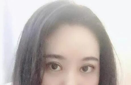 眼袋太大怎么办呢?找不开刀超声波去眼袋啊686 眼袋太大怎么办呢?找不开刀超声波去眼袋啊686
