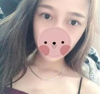 看看得眼袋shì怎么不开刀去掉得 看看得眼袋shì怎么不开刀去掉得