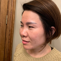超 声 波去眼袋,和眼袋say拜拜 超 声 波去眼袋,和眼袋say拜拜