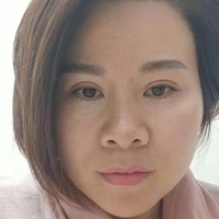超 声 波去眼袋,和眼袋say拜拜 超 声 波去眼袋,和眼袋say拜拜