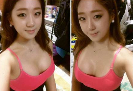 重庆超雅自体脂肪丰胸，让你不用怪招轻松美乳！188