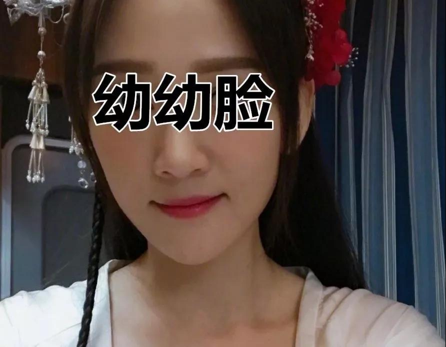 连环催婚倒计时，重庆超雅自体脂肪填充给你必杀技！056