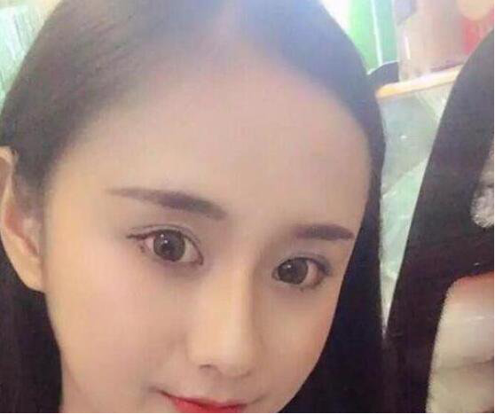 重庆超雅超声波去眼袋让这个年如此美丽905 重庆超雅超声波去眼袋让这个年如此美丽905