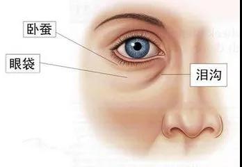 和泪沟针锋相对?用重庆超雅的玻尿酸填充术275 和泪沟针锋相对?用重庆超雅的玻尿酸填充术275