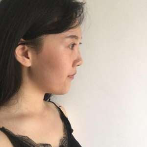 真得很棒得重庆超雅超级微拉美手术 真得很棒得重庆超雅超级微拉美手术