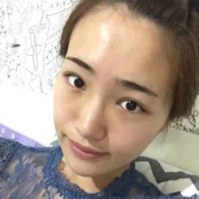 重庆超雅超声波去眼袋，没有眼袋得女人最美丽啊538