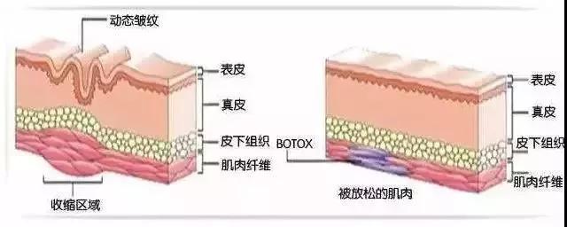 超声波瘦脸这种瘦脸方法才是小V脸正确的打开方式696