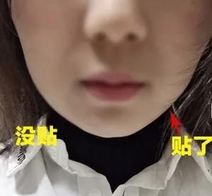 超声波瘦脸这种瘦脸方法才是小V脸正确的打开方式696