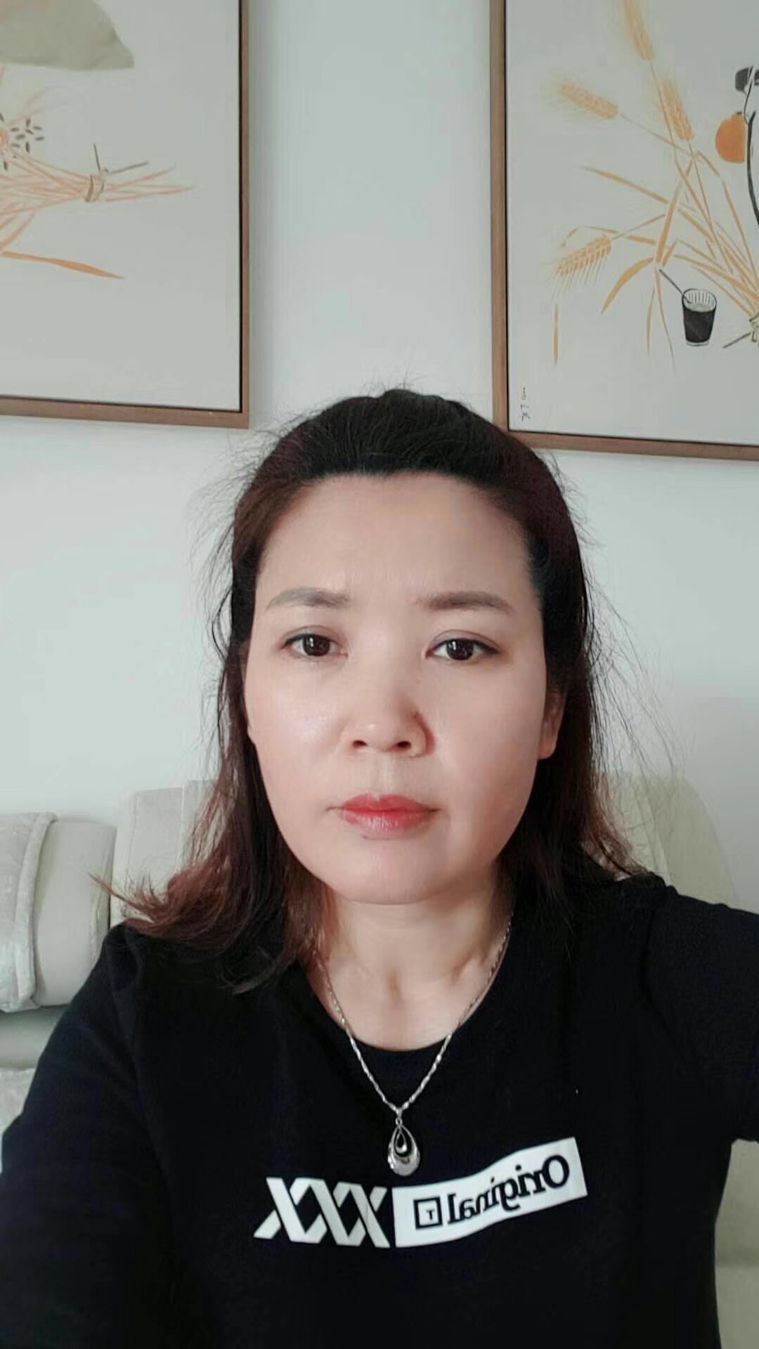 wǒ陪妈妈去超雅做le去眼袋和彭氏童颜术 wǒ陪妈妈去超雅做le去眼袋和彭氏童颜术