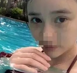 做双眼皮手术失败修复找重庆超雅的梁医生877 做双眼皮手术失败修复找重庆超雅的梁医生877