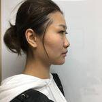 重庆超雅超声波去眼袋,精神抖擞面对明天287 重庆超雅超声波去眼袋,精神抖擞面对明天287